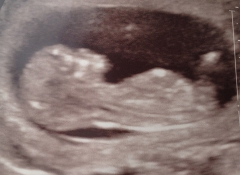 Baby Carter #2 - due January :)